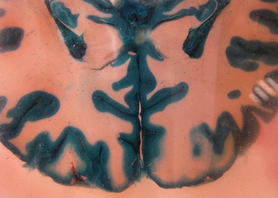 Αίθουσα της Τιμωρίας